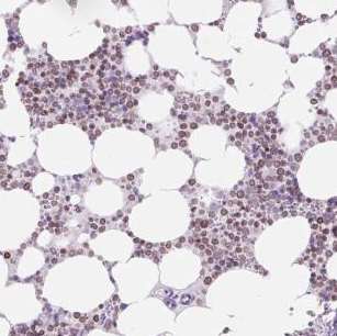 Immunohistochemistry (Formalin/PFA-fixed paraffin-embedded sections) - Anti-VPREB1 antibody (AB185480)