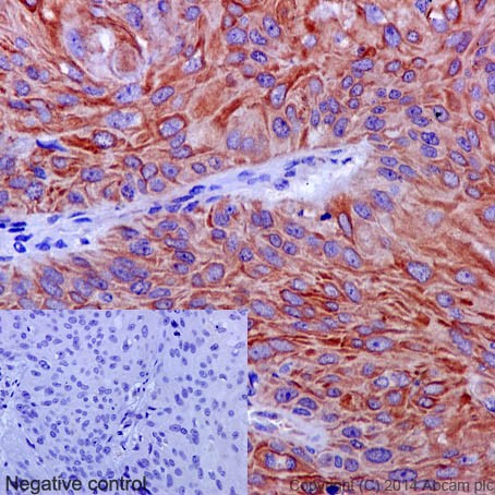 Immunohistochemistry (Formalin/PFA-fixed paraffin-embedded sections) - Anti-VPS11 antibody [EPR10344(2)] (AB189920), expandable thumbnail