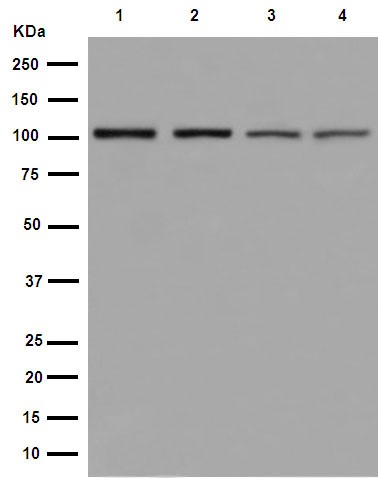 Western blot - Anti-VPS11 antibody [EPR10344(2)] (AB189920), expandable thumbnail