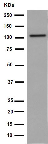 Western blot - Anti-VPS11 antibody [EPR10344(2)] (AB189920), expandable thumbnail