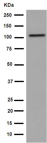 Western blot - Anti-VPS11 antibody [EPR10344(2)] (AB189920)