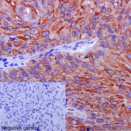 Immunohistochemistry (Formalin/PFA-fixed paraffin-embedded sections) - Anti-VPS11 antibody [EPR10344(2)] - BSA and Azide free (AB251005)