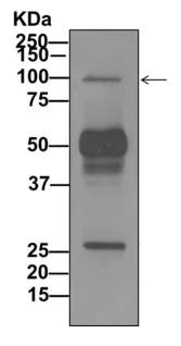Immunoprecipitation - Anti-VPS11 antibody [EPR10345] (AB170869)
