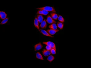 Immunocytochemistry/ Immunofluorescence - Anti-VPS11 antibody [EPR10345] - BSA and Azide free (AB249551)
