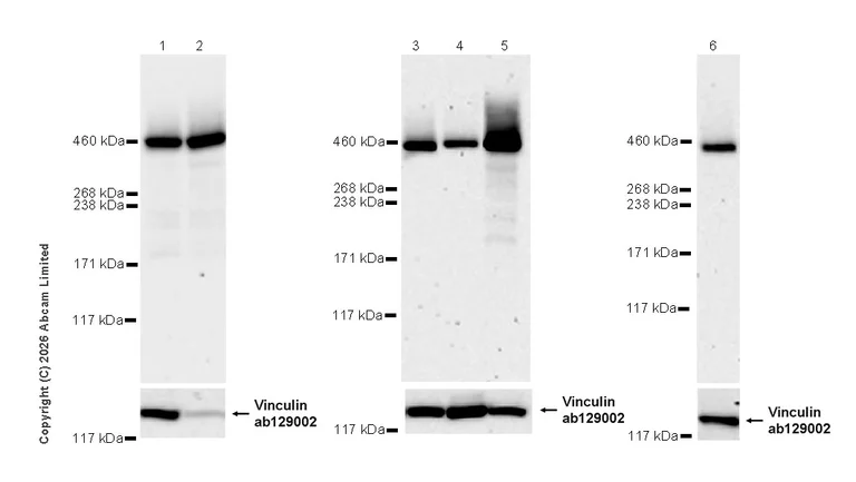Western blot - Anti-VPS13C antibody [MJF-D29760-77] - BSA and Azide free (AB326052)