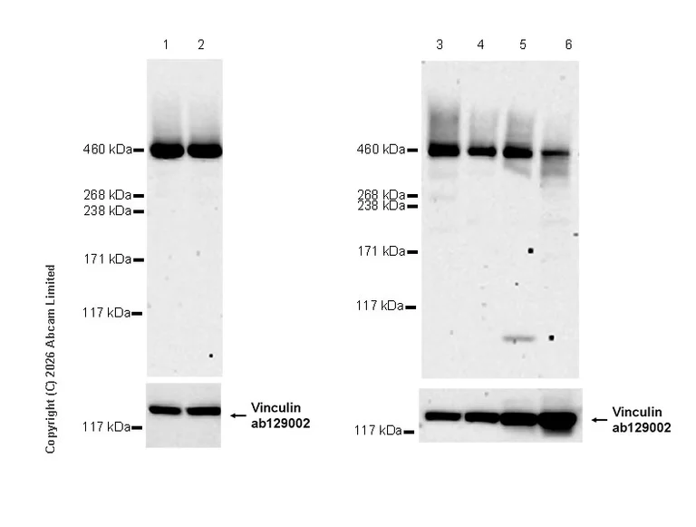 Western blot - Anti-VPS13C antibody [MJF-D29760-77] - BSA and Azide free (AB326052)