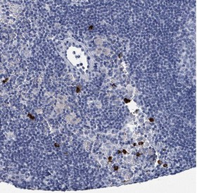 Immunohistochemistry (Formalin/PFA-fixed paraffin-embedded sections) - Anti-VPS13D antibody (AB151144)