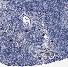 Immunohistochemistry (Formalin/PFA-fixed paraffin-embedded sections) - Anti-VPS13D antibody (AB151144)