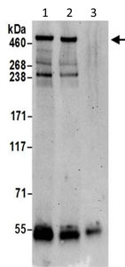 Immunoprecipitation - Anti-VPS13D antibody (AB202285)