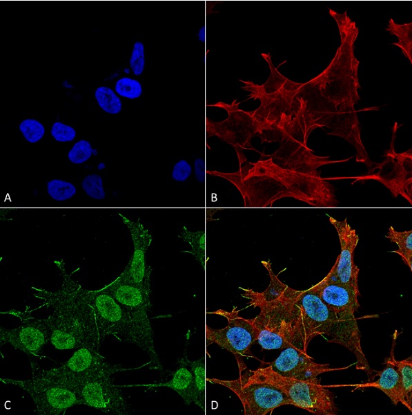 Immunocytochemistry/ Immunofluorescence - Anti-VPS15 antibody (AB240914)