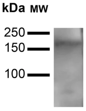 Western blot - Anti-VPS15 antibody (AB240914)
