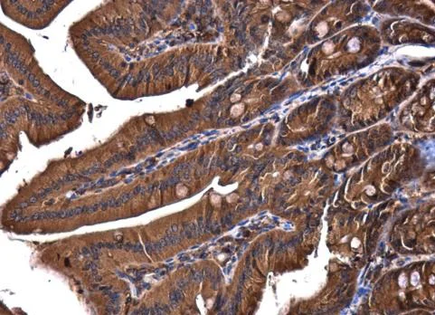 Immunohistochemistry (Formalin/PFA-fixed paraffin-embedded sections) - Anti-VPS15 antibody - C-terminal (AB229665)