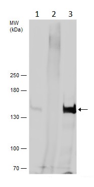 Immunoprecipitation - Anti-VPS15 antibody - C-terminal (AB229665)