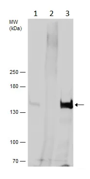 Immunoprecipitation - Anti-VPS15 antibody - C-terminal (AB229665)
