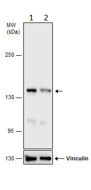 Western blot - Anti-VPS15 antibody - C-terminal (AB229665)