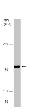 Western blot - Anti-VPS15 antibody - C-terminal (AB229665)