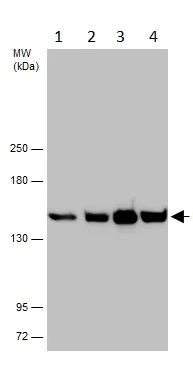 Western blot - Anti-VPS15 antibody - C-terminal (AB229665)