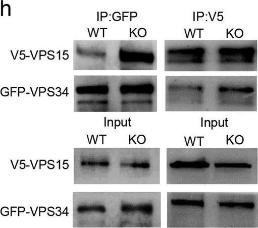 Western blot - Anti-VPS15 antibody [EPR5302(2)] (AB128903)