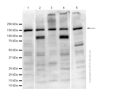 Western blot - Anti-VPS15 antibody [EPR5302(2)] - BSA and Azide free (AB248210)