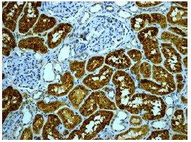 Immunohistochemistry (Formalin/PFA-fixed paraffin-embedded sections) - Anti-VPS15 antibody [EPR5303(2)] - BSA and Azide free (AB248019)