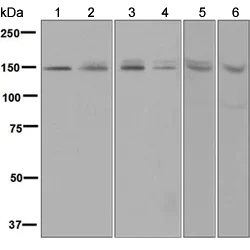Western blot - Anti-VPS15 antibody [EPR5303(2)] - BSA and Azide free (AB248019)