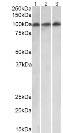 Western blot - Anti-VPS16 antibody (AB206326), expandable thumbnail