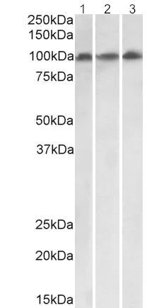 Western blot - Anti-VPS16 antibody (AB206326)
