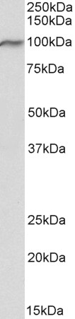 Western blot - Anti-VPS16 antibody (AB206326), expandable thumbnail