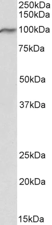 Western blot - Anti-VPS16 antibody (AB206326)