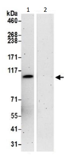 Immunoprecipitation - Anti-VPS18 antibody (AB240574), expandable thumbnail