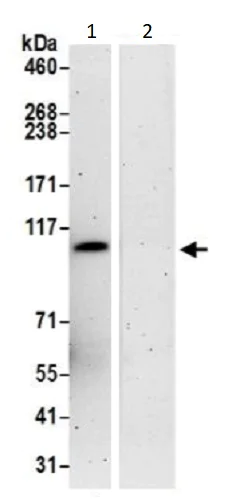 Immunoprecipitation - Anti-VPS18 antibody (AB240574)