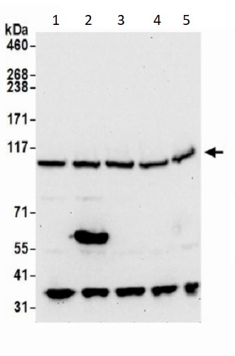 Western blot - Anti-VPS18 antibody (AB240574), expandable thumbnail
