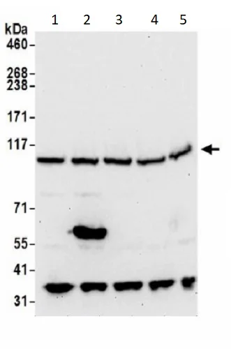 Western blot - Anti-VPS18 antibody (AB240574)