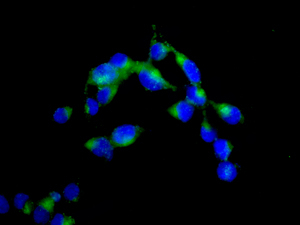 Immunocytochemistry/ Immunofluorescence - Anti-VPS18 antibody [EPR13378] - N-terminal (AB178416), expandable thumbnail