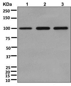 Western blot - Anti-VPS18 antibody [EPR13378] - N-terminal (AB178416), expandable thumbnail