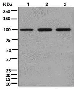 Western blot - Anti-VPS18 antibody [EPR13378] - N-terminal (AB178416)