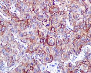 Immunohistochemistry (Formalin/PFA-fixed paraffin-embedded sections) - Anti-VPS24 antibody [EPR12821] - BSA and Azide free (AB249897), expandable thumbnail