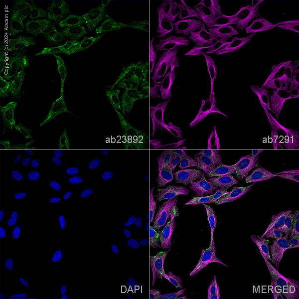 Immunocytochemistry/ Immunofluorescence - Anti-VPS26 antibody (ab23892), expandable thumbnail