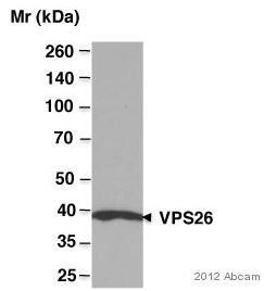 Western blot - Anti-VPS26 antibody (AB23892), expandable thumbnail