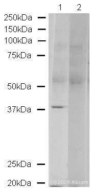 Western blot - Anti-VPS26 antibody (AB23892), expandable thumbnail