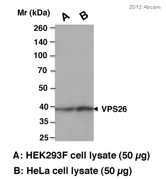 Western blot - Anti-VPS26 antibody (AB23892), expandable thumbnail