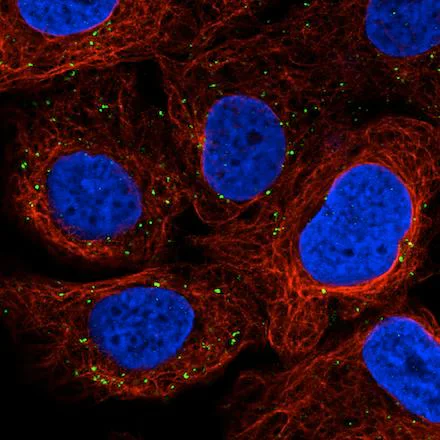 Immunocytochemistry/ Immunofluorescence - Anti-VPS26 antibody [CL2287] - C-terminal (AB211530)