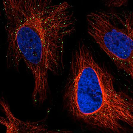Immunocytochemistry/ Immunofluorescence - Anti-VPS26 antibody [CL2287] - C-terminal (AB211530)