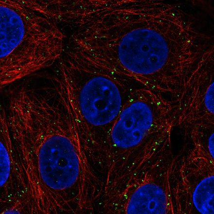 Immunocytochemistry/ Immunofluorescence - Anti-VPS26 antibody [CL2287] - C-terminal (AB211530)