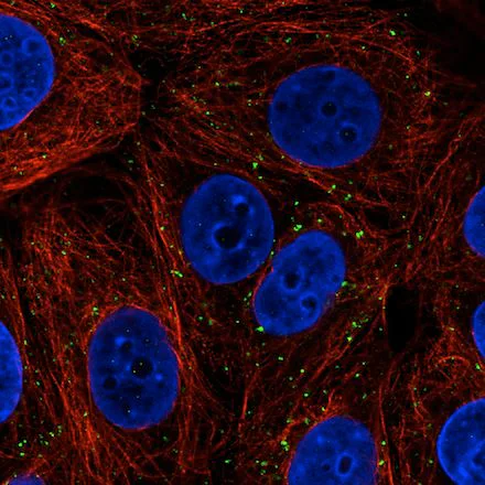 Immunocytochemistry/ Immunofluorescence - Anti-VPS26 antibody [CL2287] - C-terminal (AB211530)