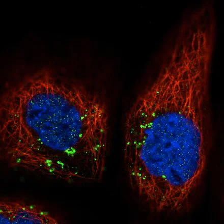 Immunocytochemistry/ Immunofluorescence - Anti-VPS26 antibody [CL2287] - C-terminal (AB211530)