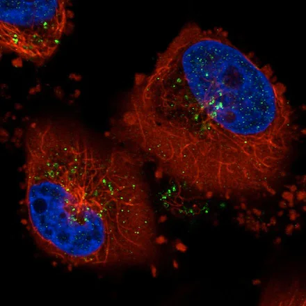 Immunocytochemistry/ Immunofluorescence - Anti-VPS26 antibody [CL2287] - C-terminal (AB211530)