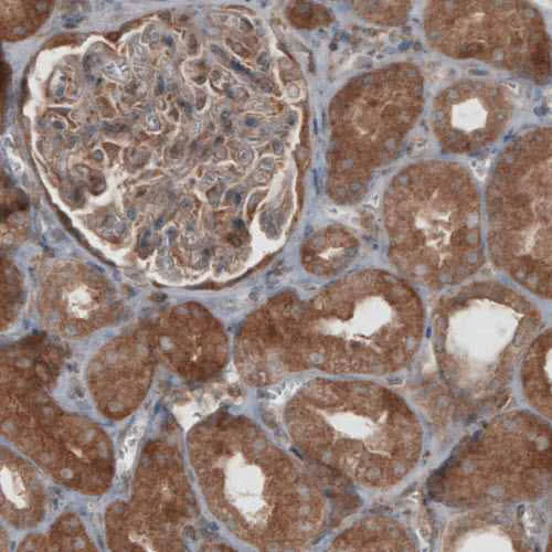 Immunohistochemistry (Formalin/PFA-fixed paraffin-embedded sections) - Anti-VPS26 antibody [CL2287] - C-terminal (AB211530)