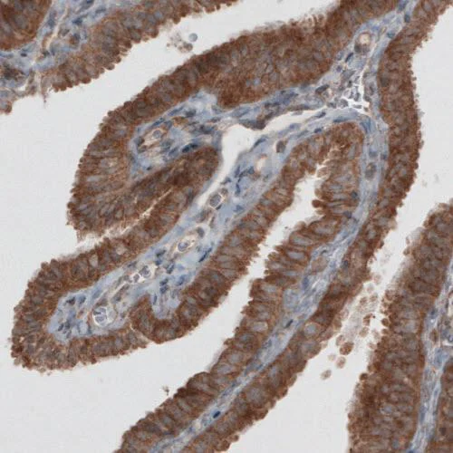 Immunohistochemistry (Formalin/PFA-fixed paraffin-embedded sections) - Anti-VPS26 antibody [CL2287] - C-terminal (AB211530)