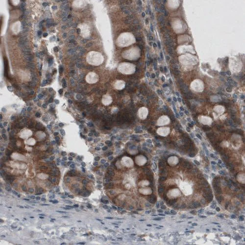 Immunohistochemistry (Formalin/PFA-fixed paraffin-embedded sections) - Anti-VPS26 antibody [CL2287] - C-terminal (AB211530)